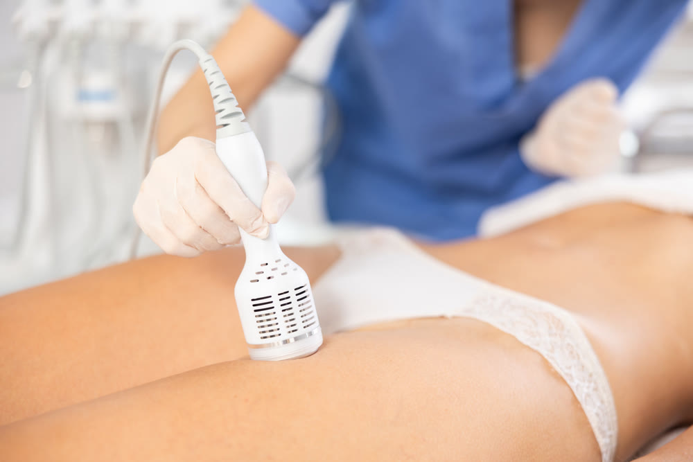 Aesthetician performing cryotherapy using cooling attachment on female client thighs
